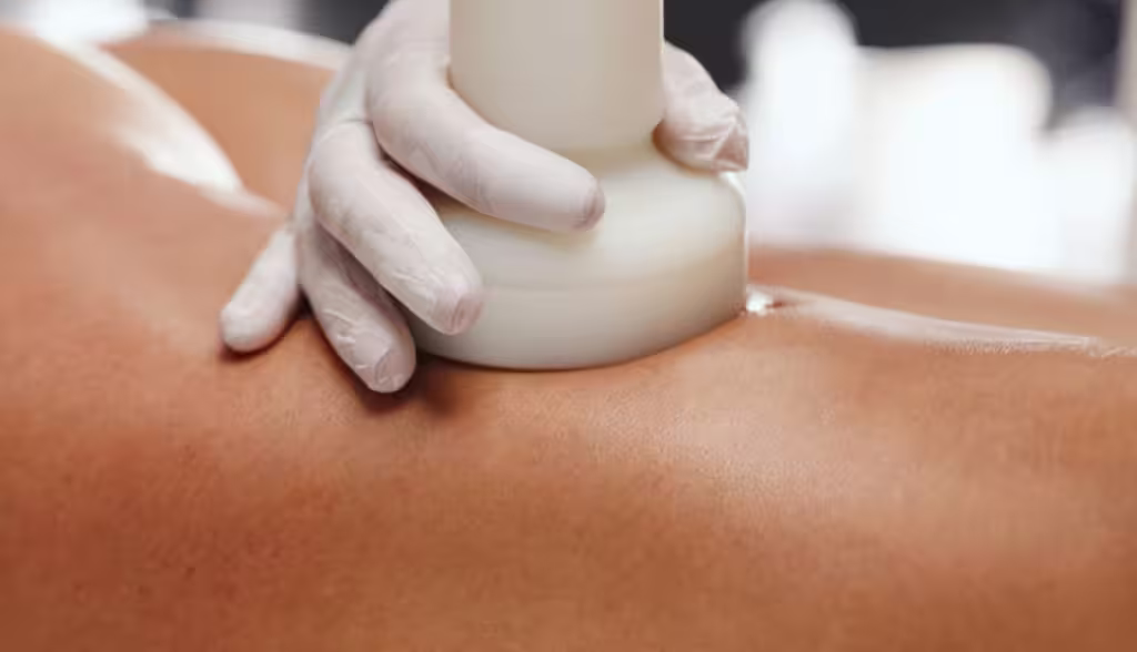 Body treatment with vacuum therapy - Contour Shape Body vacuum therapy application during a Contour Shape treatment in Bogotá