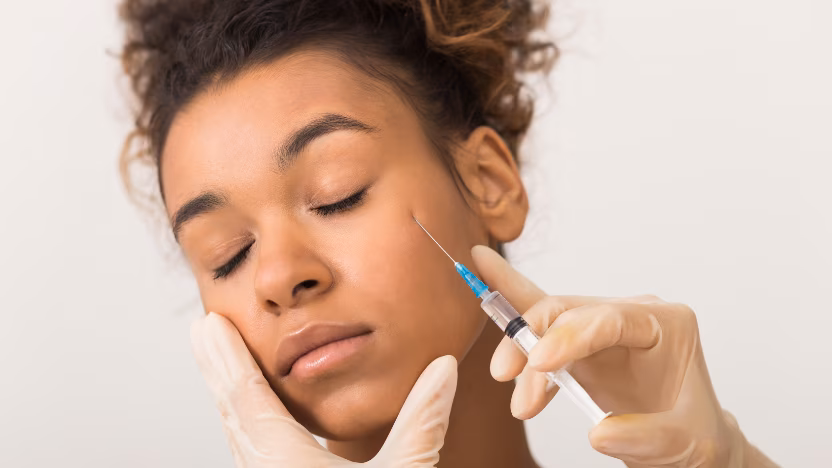 Hyaluronic acid injection technique at certified medical clinic, Dr. Tatiana Leal Bogotá