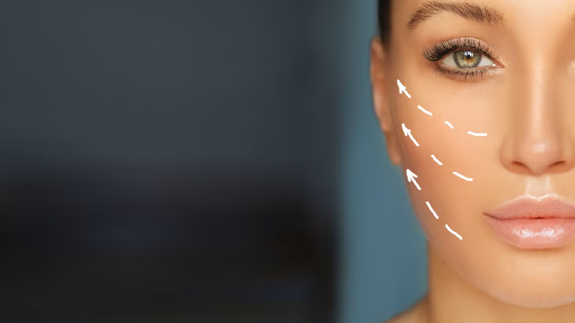 Under-eye hollows and folds treatment with hyaluronic acid for facial rejuvenation, Dr. Tatiana Leal