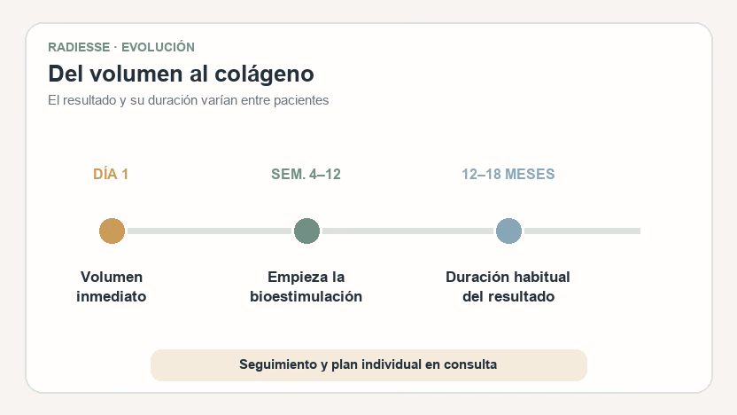 Cuánto dura Radiesse: evolución del resultado desde el día 1 hasta los 12 a 18 meses