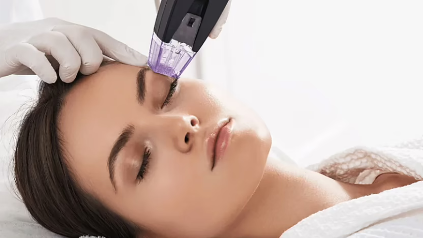 Difference between HIFU facial and facial radiofrequency treatment Bogotá