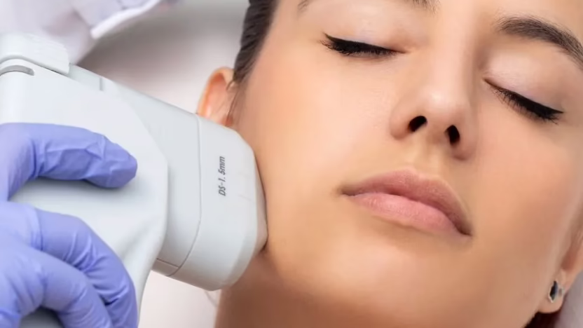 HIFU facial resultados lifting sin cirugía Bogotá