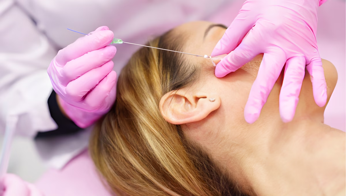 Magic Threads: What They Are, Uses and Benefits in Aesthetic Medicine | Dr. Tatiana Leal