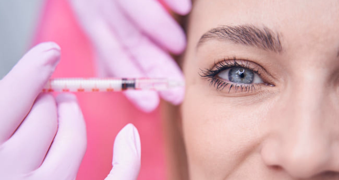 líneas de expresión en los ojos patas de gallo tratamiento