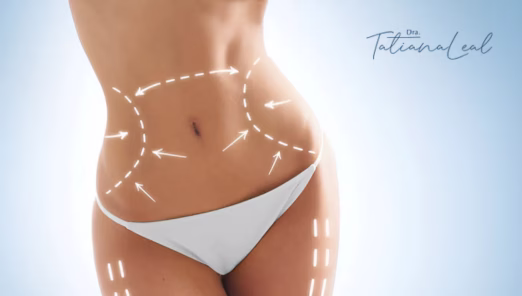 Comparison between liposuction and lipolysis procedures