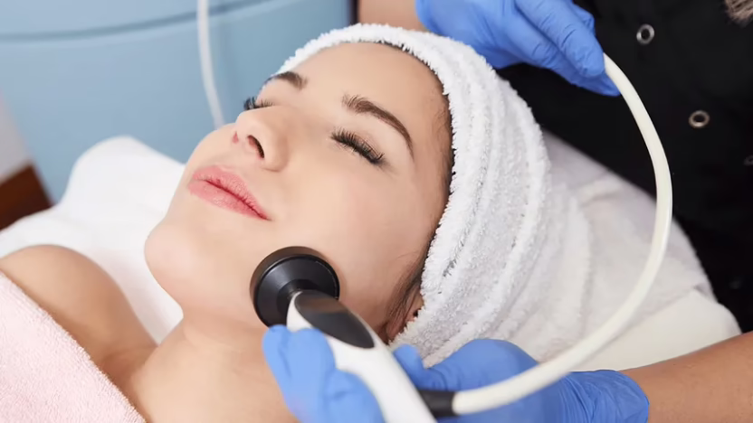 Radiofrecuencia facial tipos y resultados reales Tatiana Leal