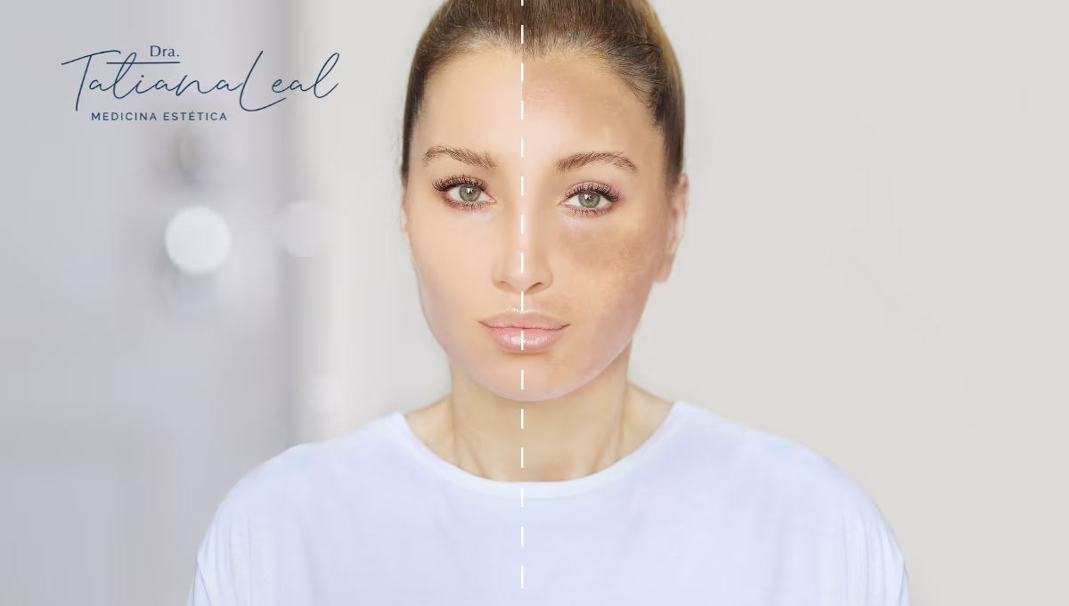 How to Remove Dark Spots on Skin: Where in Colombia