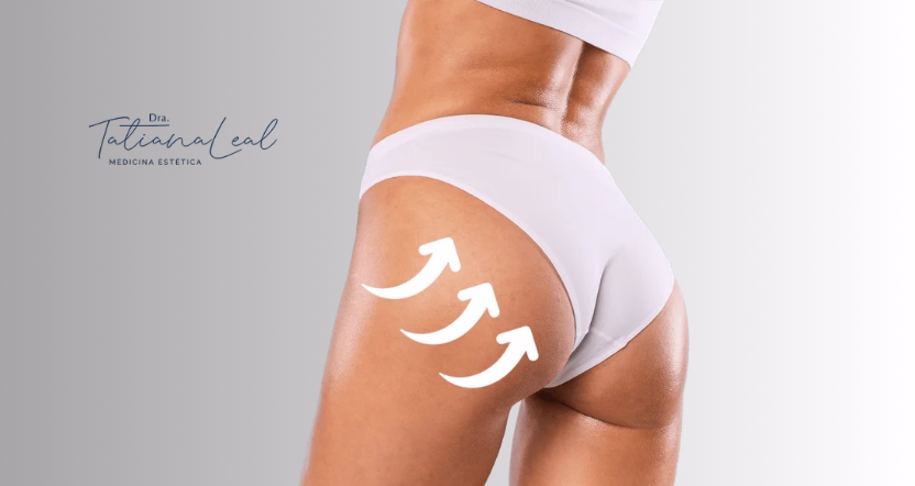 Sculptra buttocks results before and after