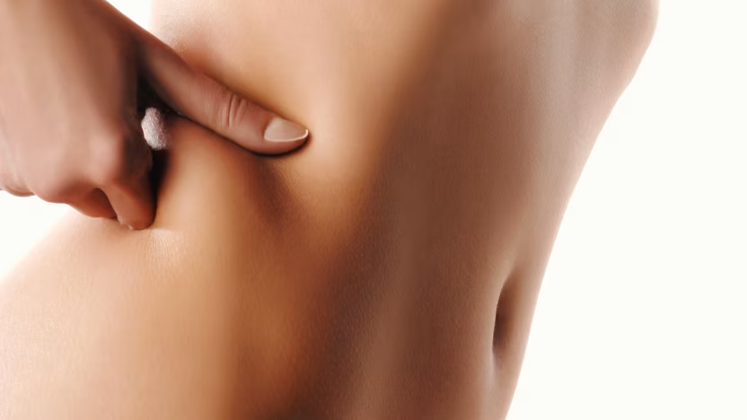 Sculptor HIFEM generating supramaximal contractions in the abdomen, Dr. Tatiana Leal clinic Bogotá