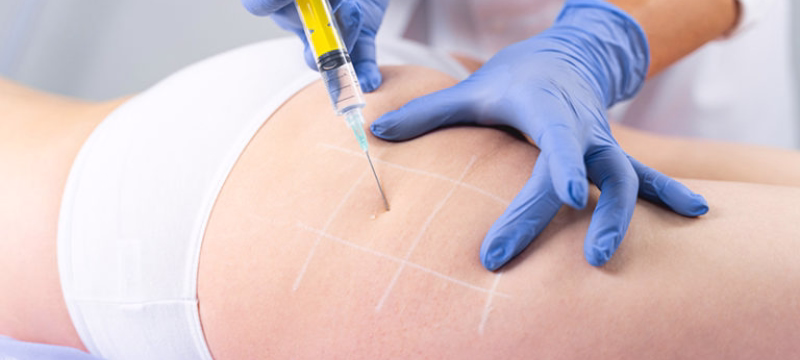 Sculptra cost per vial in Colombia 2025: $750,000 to $1,400,000 COP