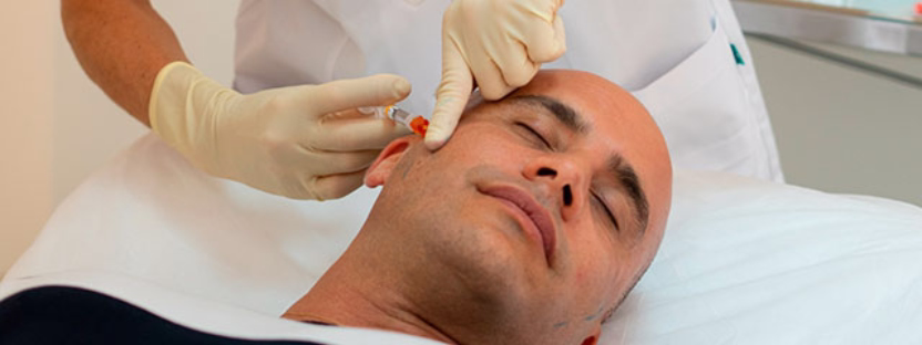 How Sculptra works: natural collagen biostimulation