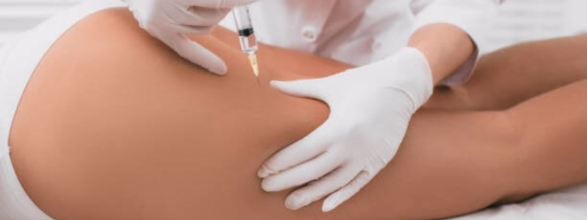 Texture and pores: why Sculptra upgrades skin architecture