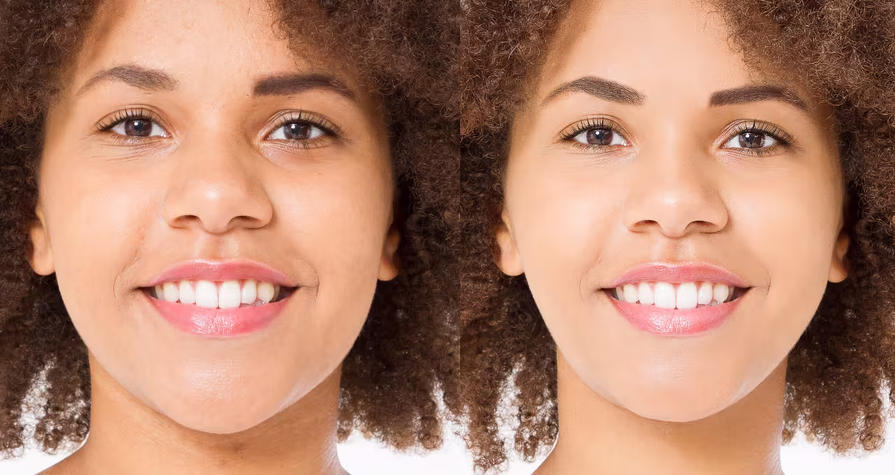 De ®Ultraskin a ®DermaZoom: el tratamiento mejorado de este 2025