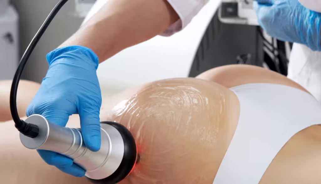 Contour Shape Treatment performed by Dr. Tatiana Leal