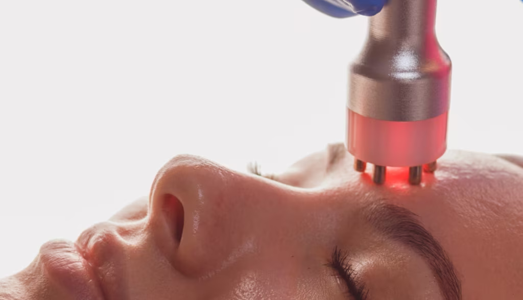 HIFU facial Bogotá con Dermazoom Microson Pen - lifting sin cirugía Dra. Tatiana Leal