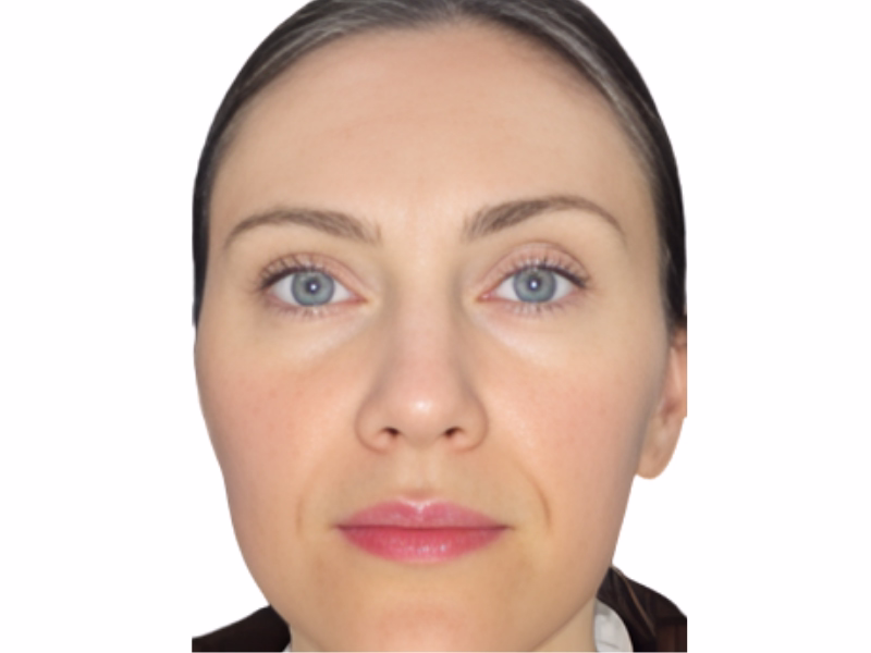 Después del Naturalidad asiática - Neuronox