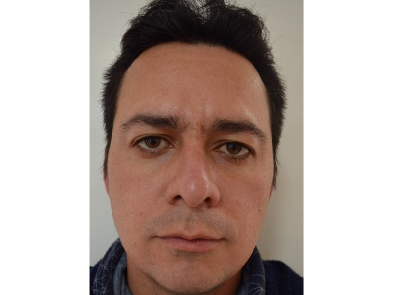 Después del Renovación completa