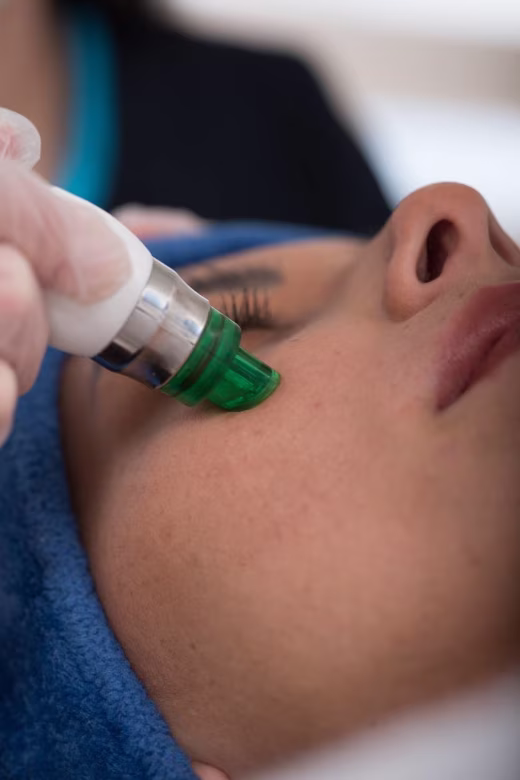 Facial laser rejuvenation treatment in Bogotá