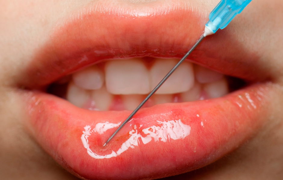 Diferencias entre líneas de código de barras y líneas de marioneta - Diagnóstico en Bogotá