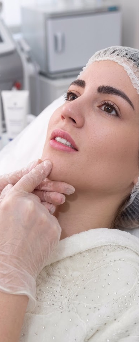 Application of barbed PDO threads using microcannula for facial rejuvenation in Bogotá