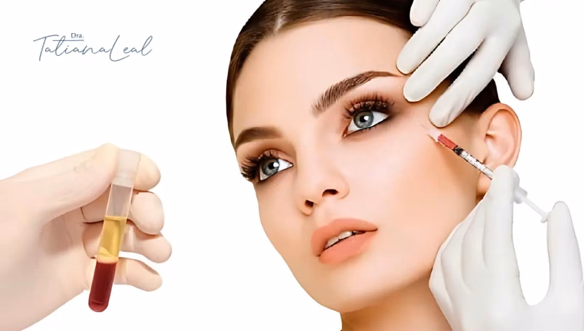 Centrifuged blood tube with the separated plasma layer and a facial PRP micro-injection