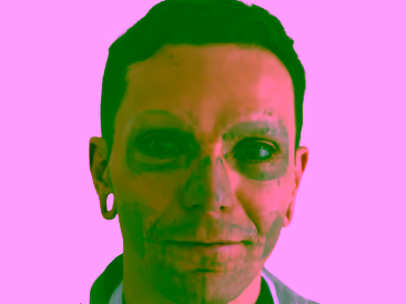 Después del Eliminación de tatuaje facial con diseño de máscara