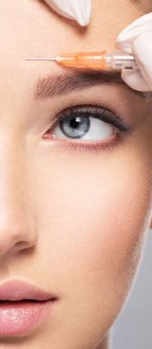 Treatment of expression lines on the forehead with Neuronox botulinum toxin in Bogotá
