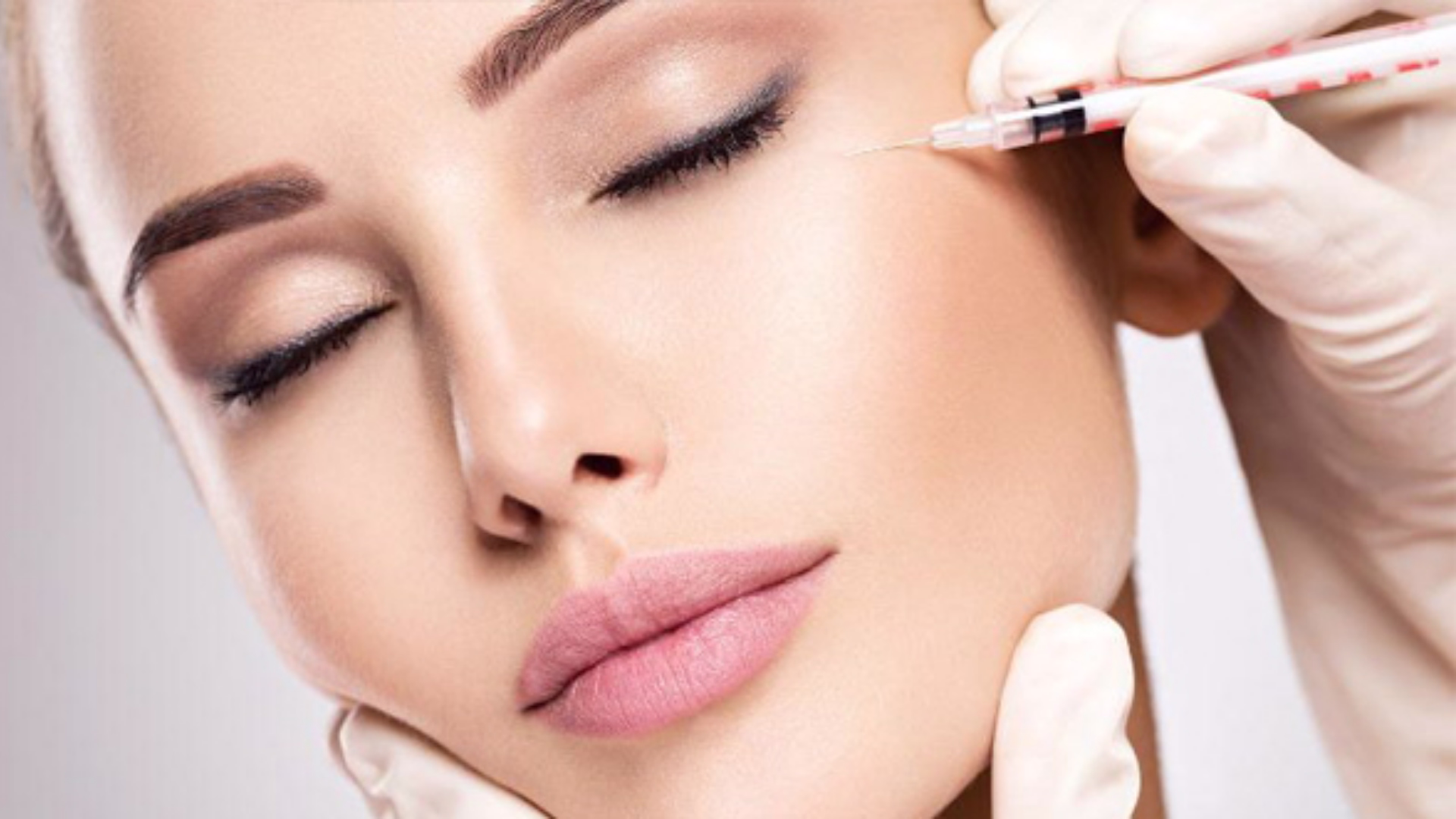 Botulinum toxin for crow's feet | Dr. Tatiana Leal