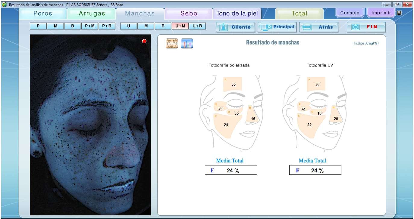 Dra Tatiana Leal Janus ll para analisis facial